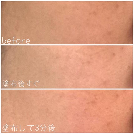 タカミスキンピール/タカミ/ブースター・導入液を使ったクチコミ(5枚目)