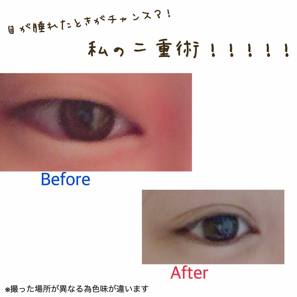 のびーるアイテープ(絆創膏タイプ、レギュラー)/DAISO/二重まぶた用アイテムを使ったクチコミ(1枚目)