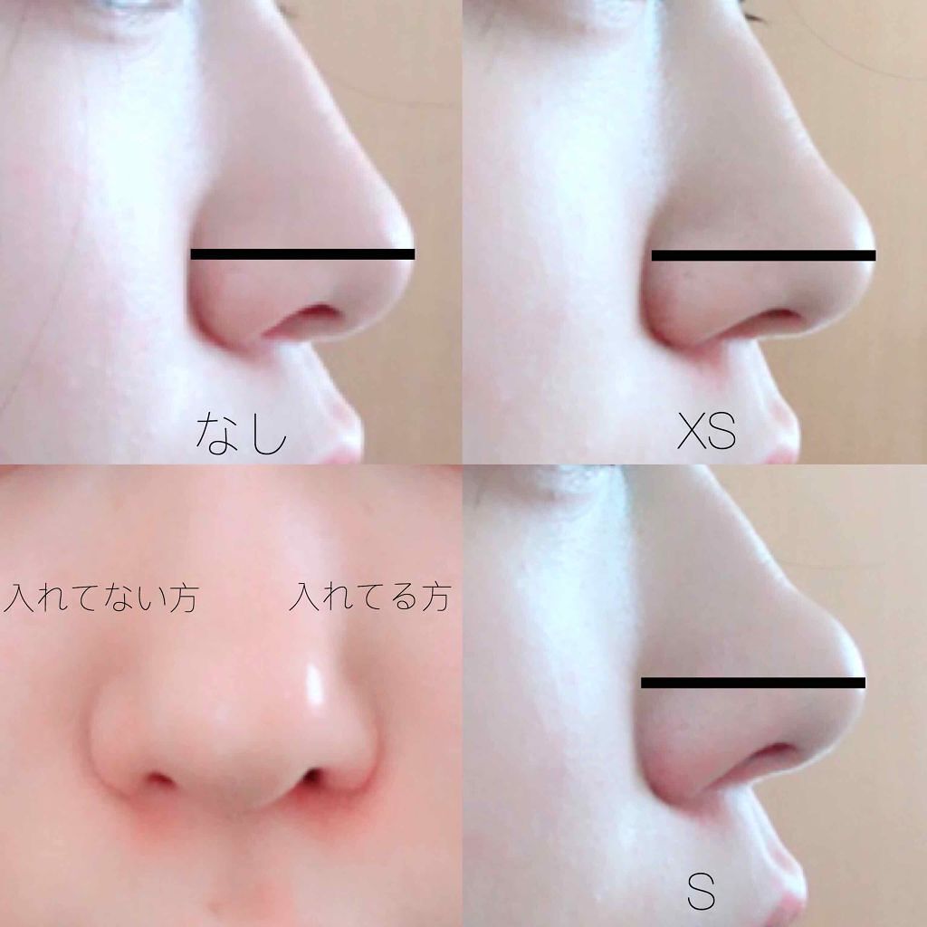 ◇ 鼻プチ　３サイズ セット ノーズアップ 矯正 整形