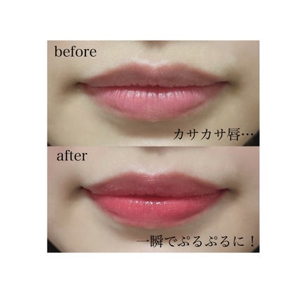 ジューシーリッププランパー6g/TPSY/リッププランパーを使ったクチコミ(5枚目)