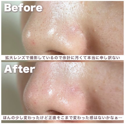 ソフィーナ iP ポア クリアリング ジェル ウォッシュ/SOFINA iP/その他洗顔料を使ったクチコミ(5枚目)