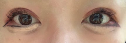 コンシーラーS/media/クリームコンシーラーを使ったクチコミ(2枚目)