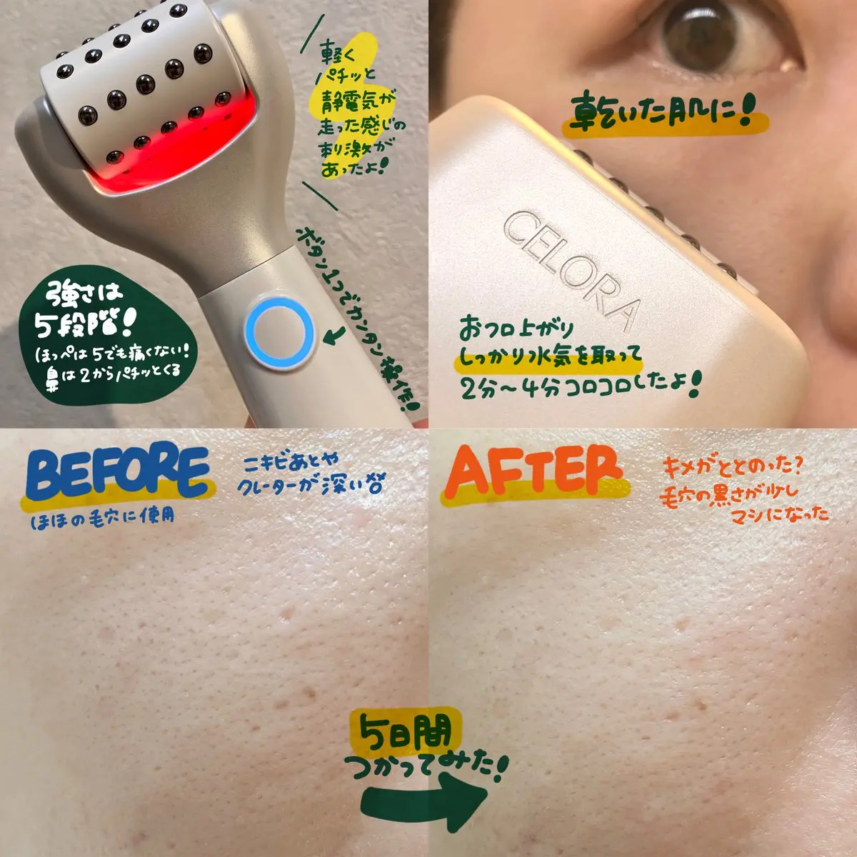 ポアタイトニングブーストセラム/CELORABY/美容液を使ったクチコミ（2枚目）
