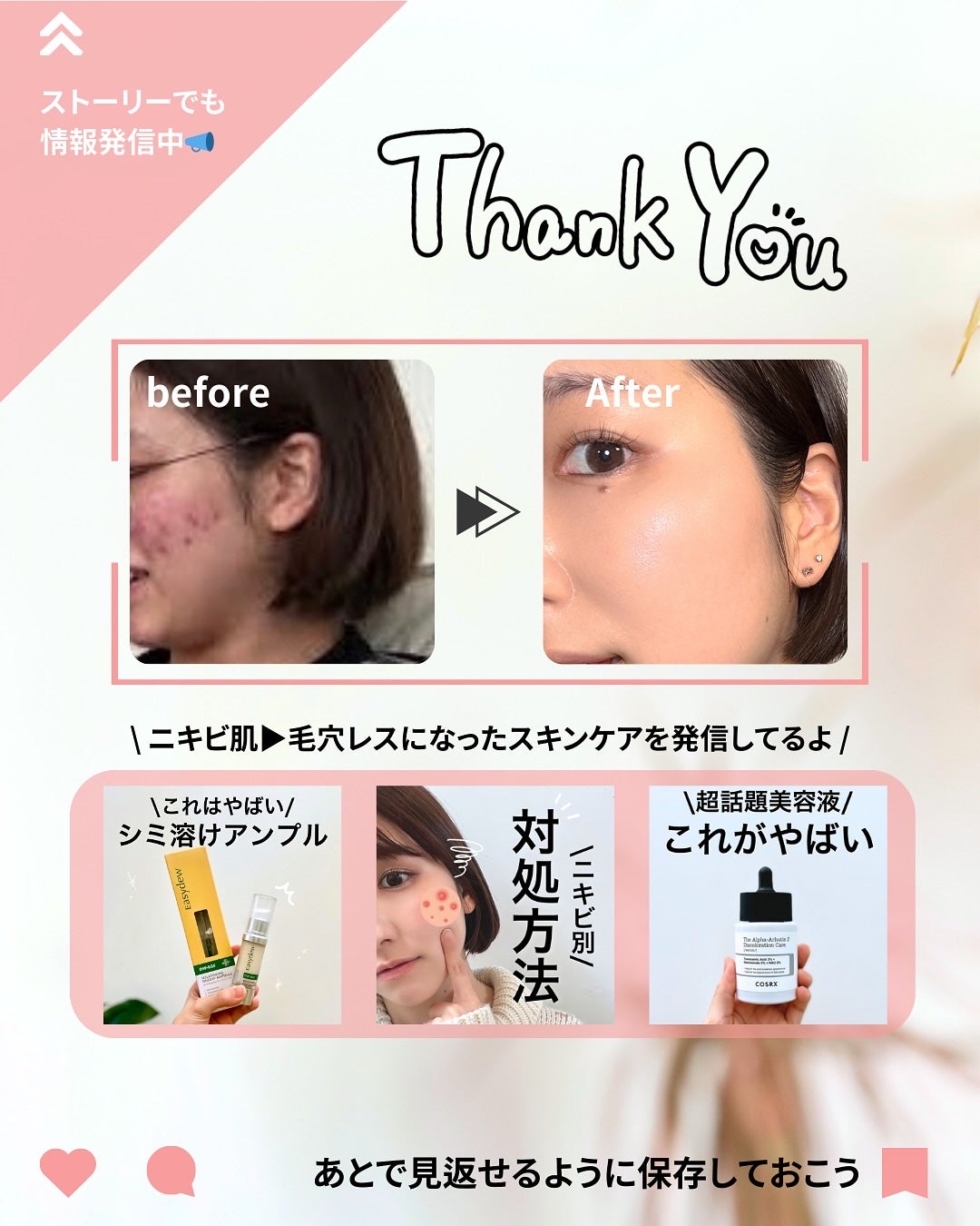 なぎ | スキンケア薬剤師 on LIPS 「◀︎ニキビ肌から毛穴レスになった薬剤師肌悩みにダイレクトアタッ..」(10枚目)