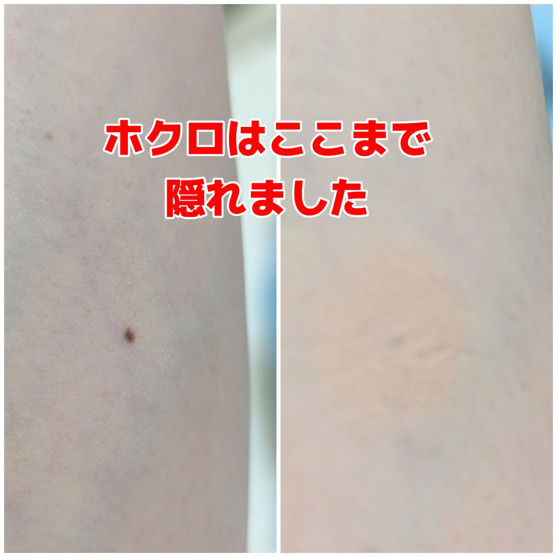 コンシーラーS/media/クリームコンシーラーを使ったクチコミ（2枚目）