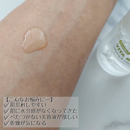 ビタボムセラム/Frankly/美容液を使ったクチコミ(3枚目)