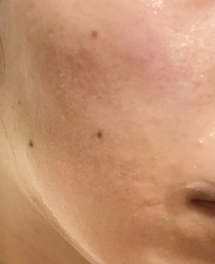 ももぷり フレッシュピールオフパック/ももぷり/ピーリングを使ったクチコミ(3枚目)