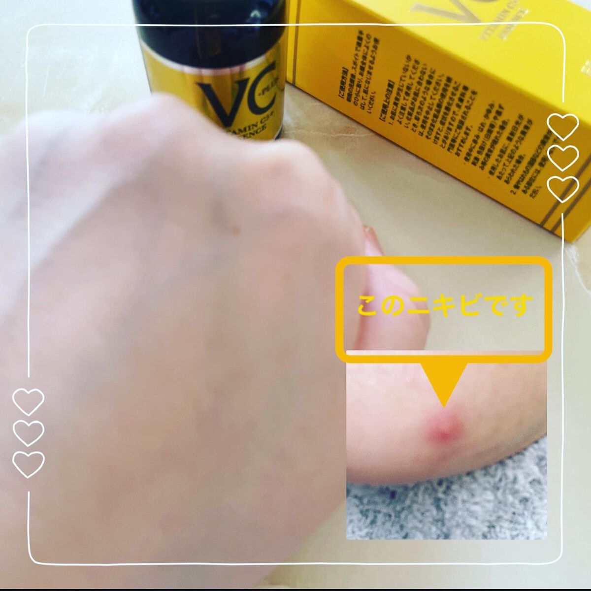 Cエッセンス/EBiS化粧品/美容液を使ったクチコミ(3枚目)