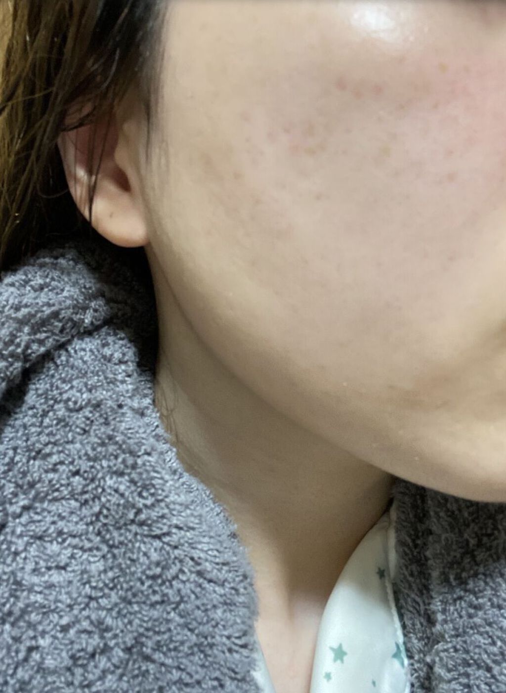 ホワイトニング エッセンス/アルージェ/美容液を使ったクチコミ（1枚目）