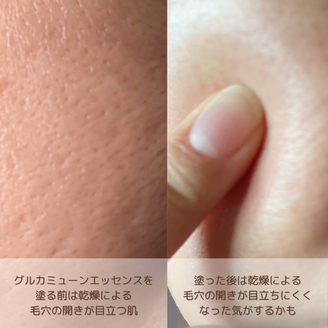 グルカミューンエッセンス /VT/美容液を使ったクチコミ（3枚目）