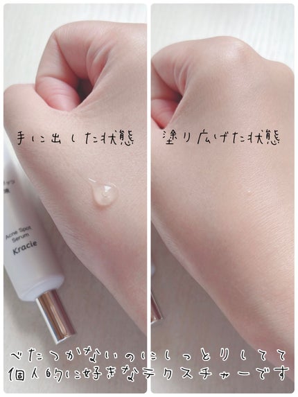 大人のニキビ対策 薬用クリアスポッツ美容液 /肌美精/美容液を使ったクチコミ(4枚目)