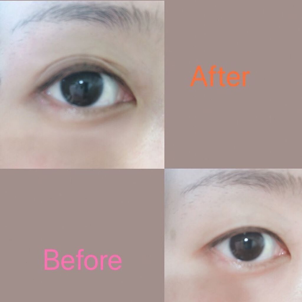 メザイク フリーファイバー120 スタンダードタイプ /メザイク/二重まぶた用アイテムを使ったクチコミ（2枚目）