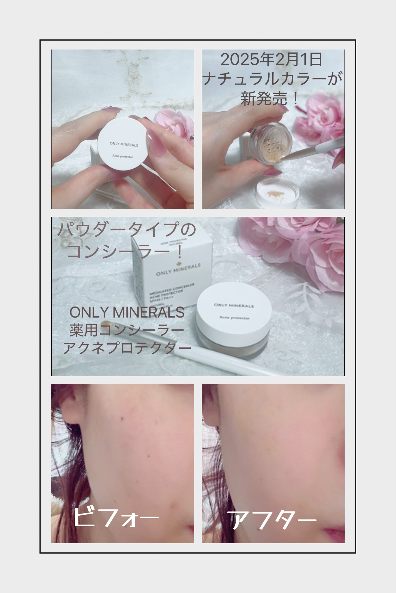 薬用コンシーラー アクネプロテクター/ONLY MINERALS/パウダーコンシーラーを使ったクチコミ（1枚目）