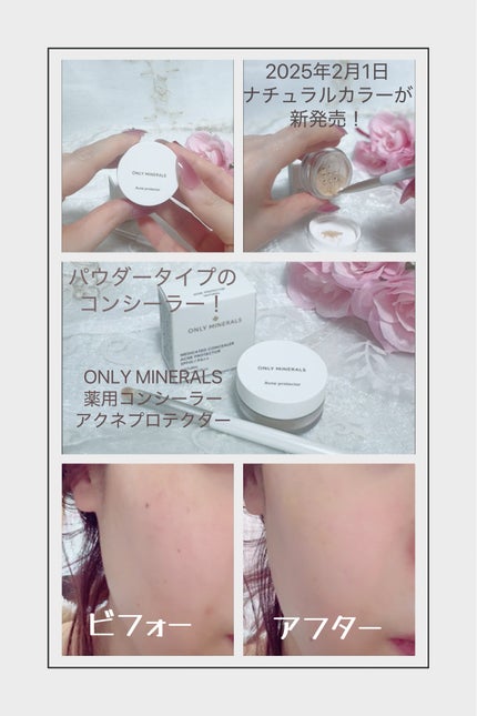 薬用コンシーラー アクネプロテクター/ONLY MINERALS/パウダーコンシーラーを使ったクチコミ(1枚目)