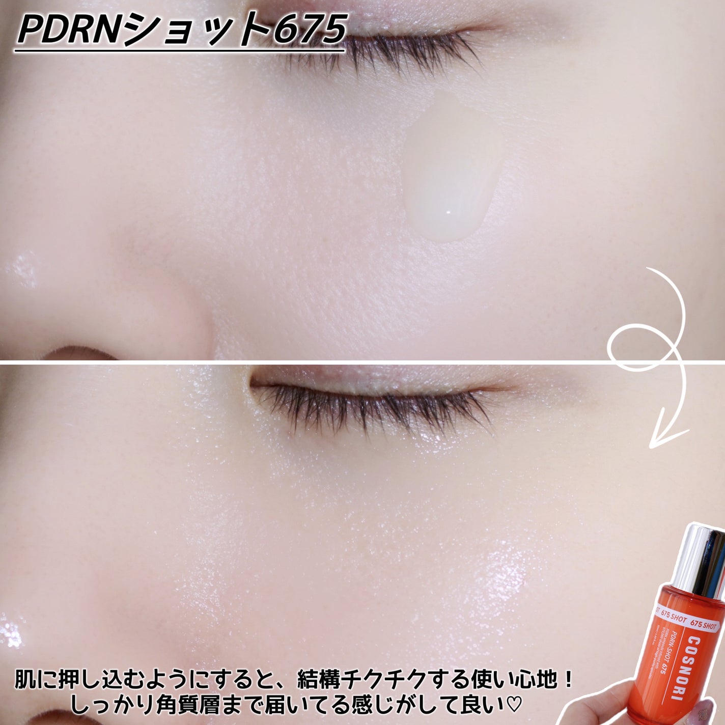 PDRNショット675/COSNORI/美容液を使ったクチコミ(5枚目)