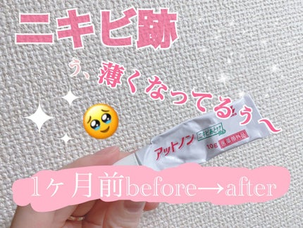 ニキビあとケアジェル/アットノン/その他スキンケアを使ったクチコミ(1枚目)