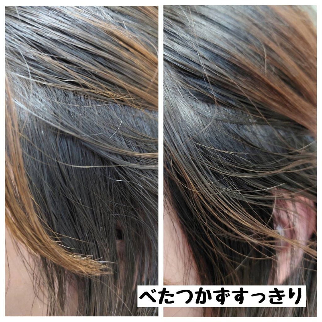 メディカルスカルプスパエッセンス/ティアレラプラス/頭皮ローションを使ったクチコミ(5枚目)