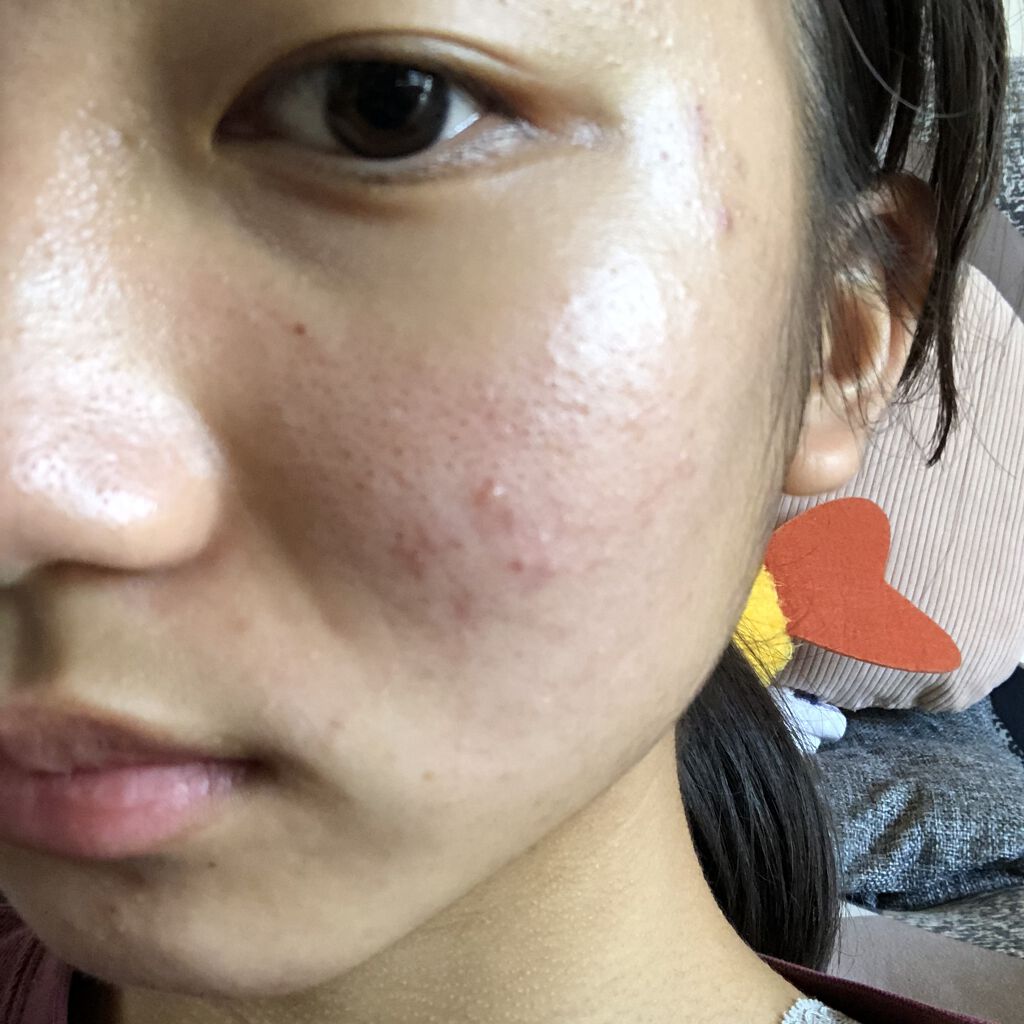 潤い化粧水/ももぷり/化粧水を使ったクチコミ（1枚目）