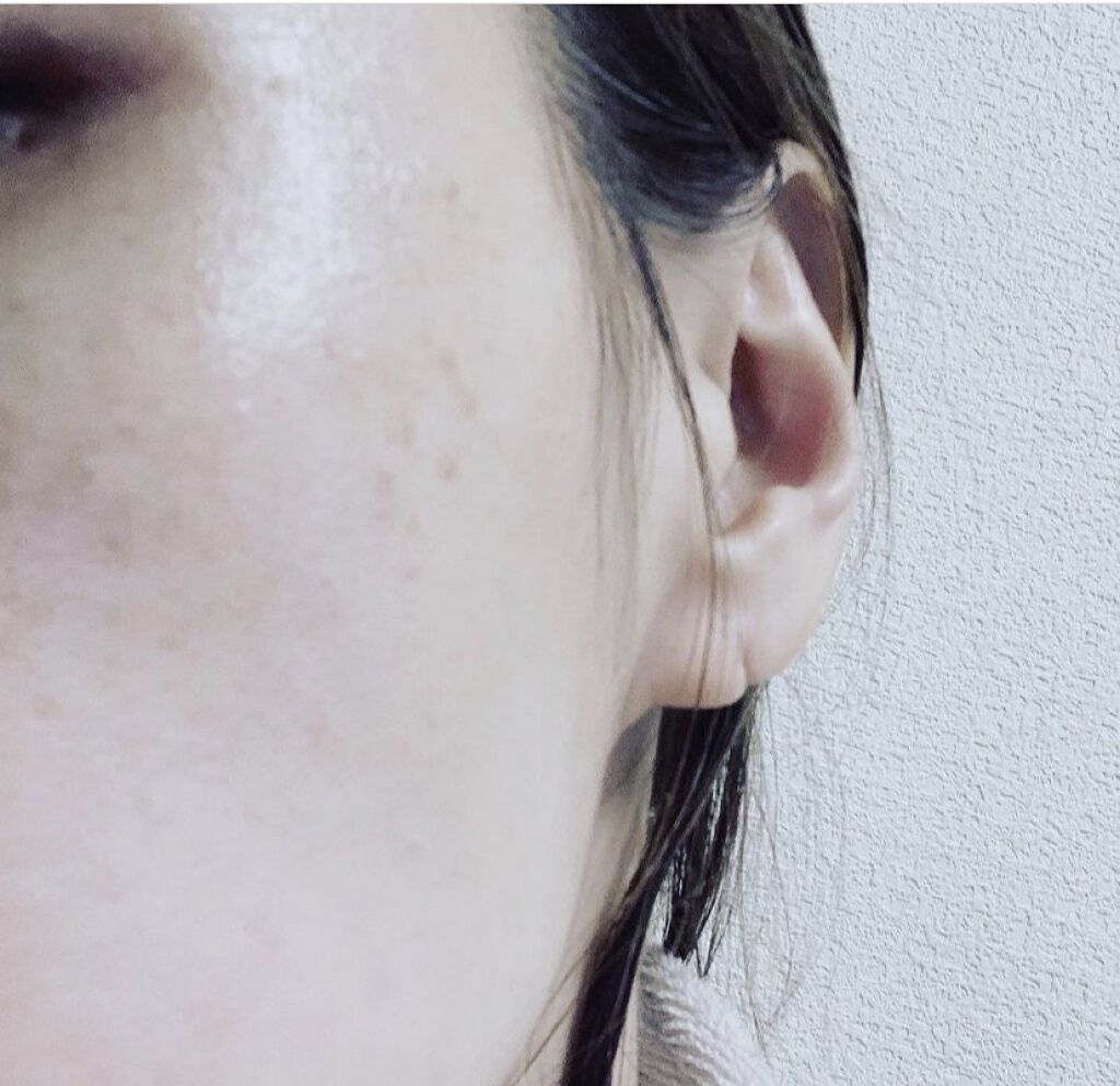 アヤナストライアルオイル状美容液/DECENCIA/美容液を使ったクチコミ（3枚目）