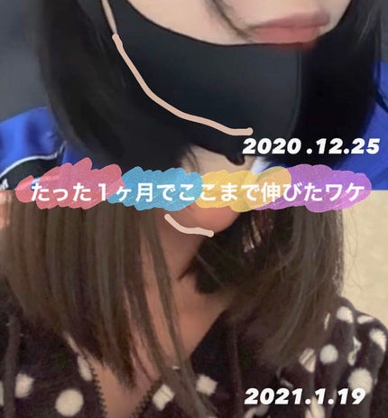 DHC 亜鉛/DHC/健康サプリメントを使ったクチコミ(1枚目)