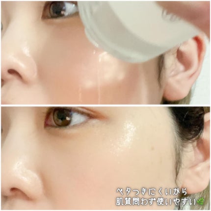 ドクダミ 77 スージングトナー/Anua/化粧水を使ったクチコミ(5枚目)