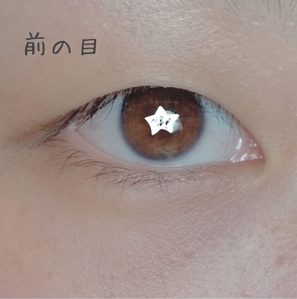 ワンダーアイリッドテープ Extra/D-UP/二重まぶた用アイテムを使ったクチコミ（2枚目）