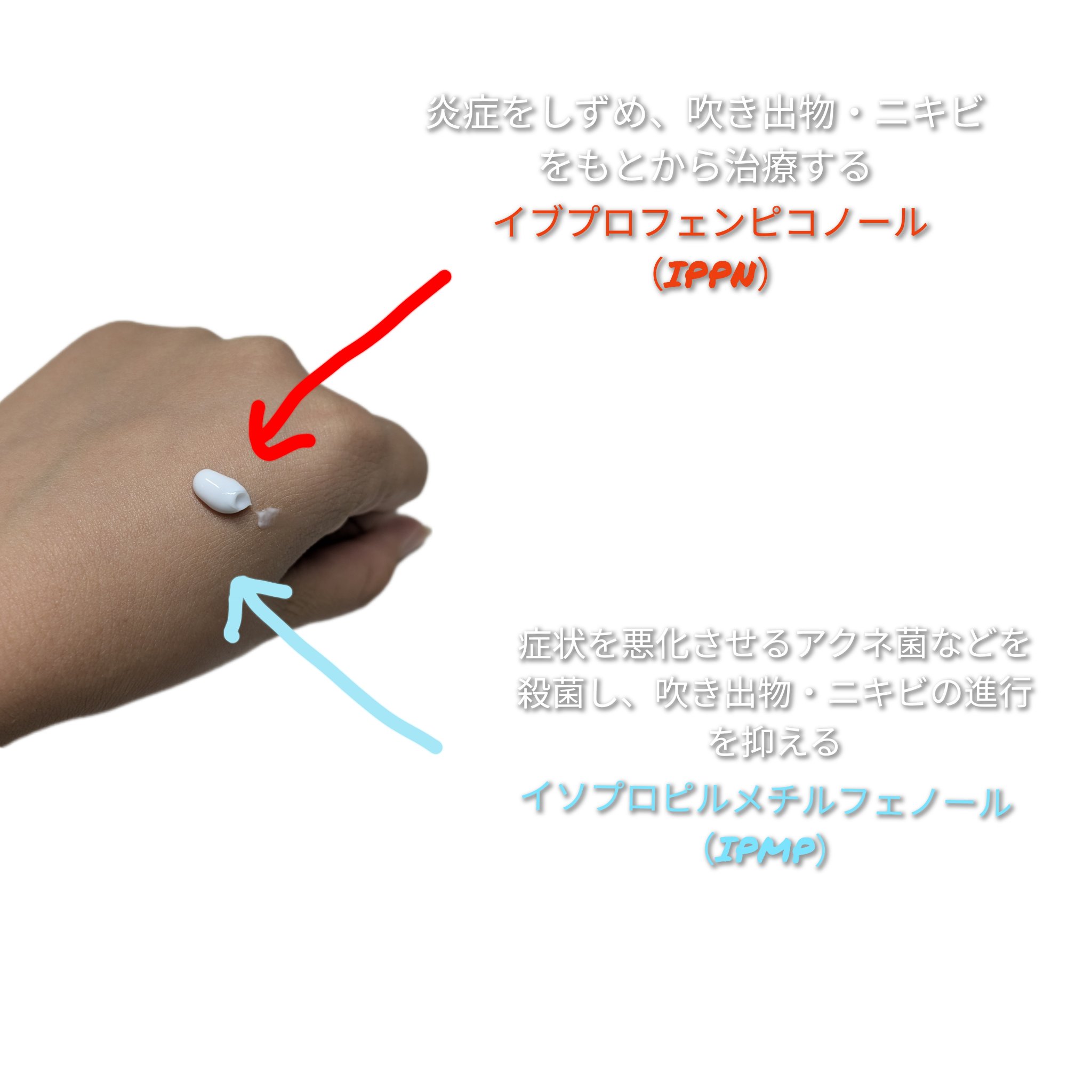 ペアアクネクリームW(医薬品)/ペア/その他を使ったクチコミ（3枚目）