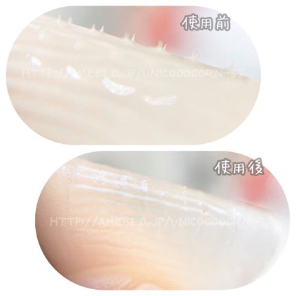 ヒアロビューティーマイクロパッチ/太陽のアロエ社/シートマスク・パックを使ったクチコミ(5枚目)