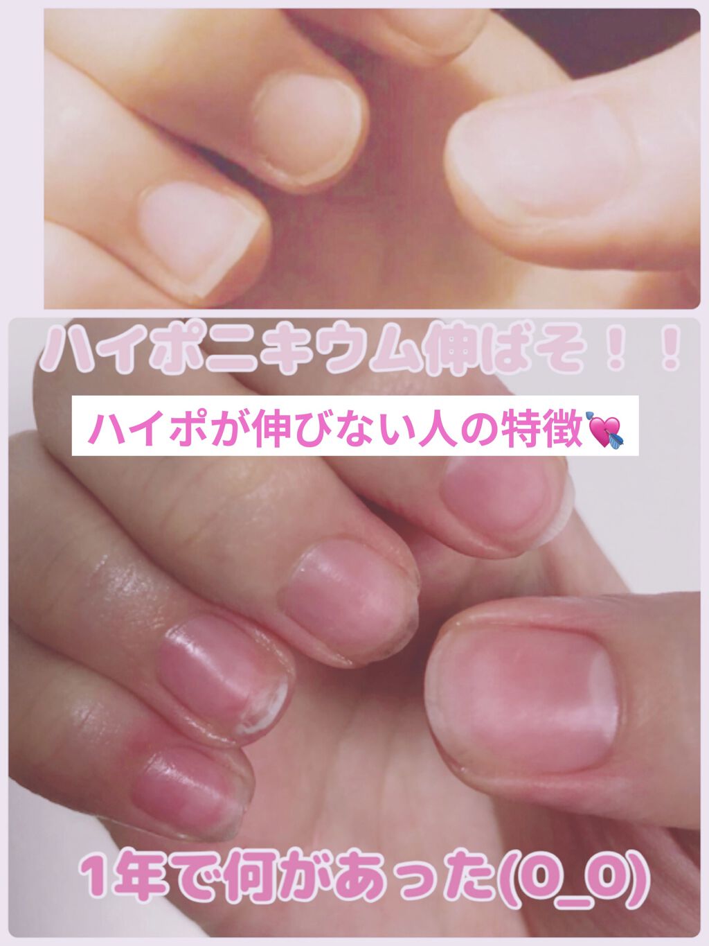 Somptueux ソンプチュー ネイルオイル Daisoを使った口コミ ハイポニキウムが伸びない人必見 お久 By のばら 乾燥肌 代前半 Lips