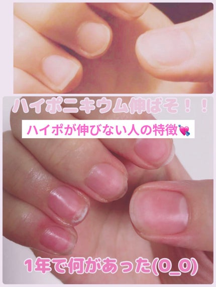 Somptueux(ソンプチュー) ネイルオイル/DAISO/ネイルオイル・トリートメントを使ったクチコミ(1枚目)