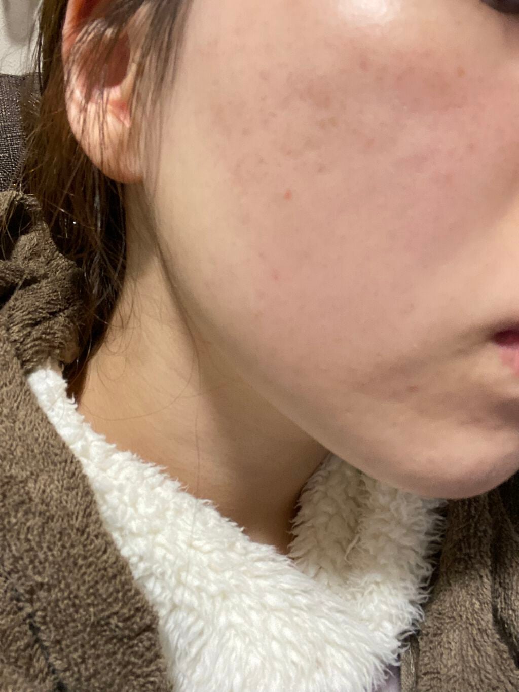 モイスチャー ミストローションII(しっとり)/アルージェ/ミスト状化粧水を使ったクチコミ(2枚目)