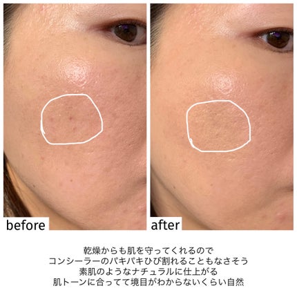 ダーマシンコンシーラー/23years old/リキッドコンシーラーを使ったクチコミ(7枚目)