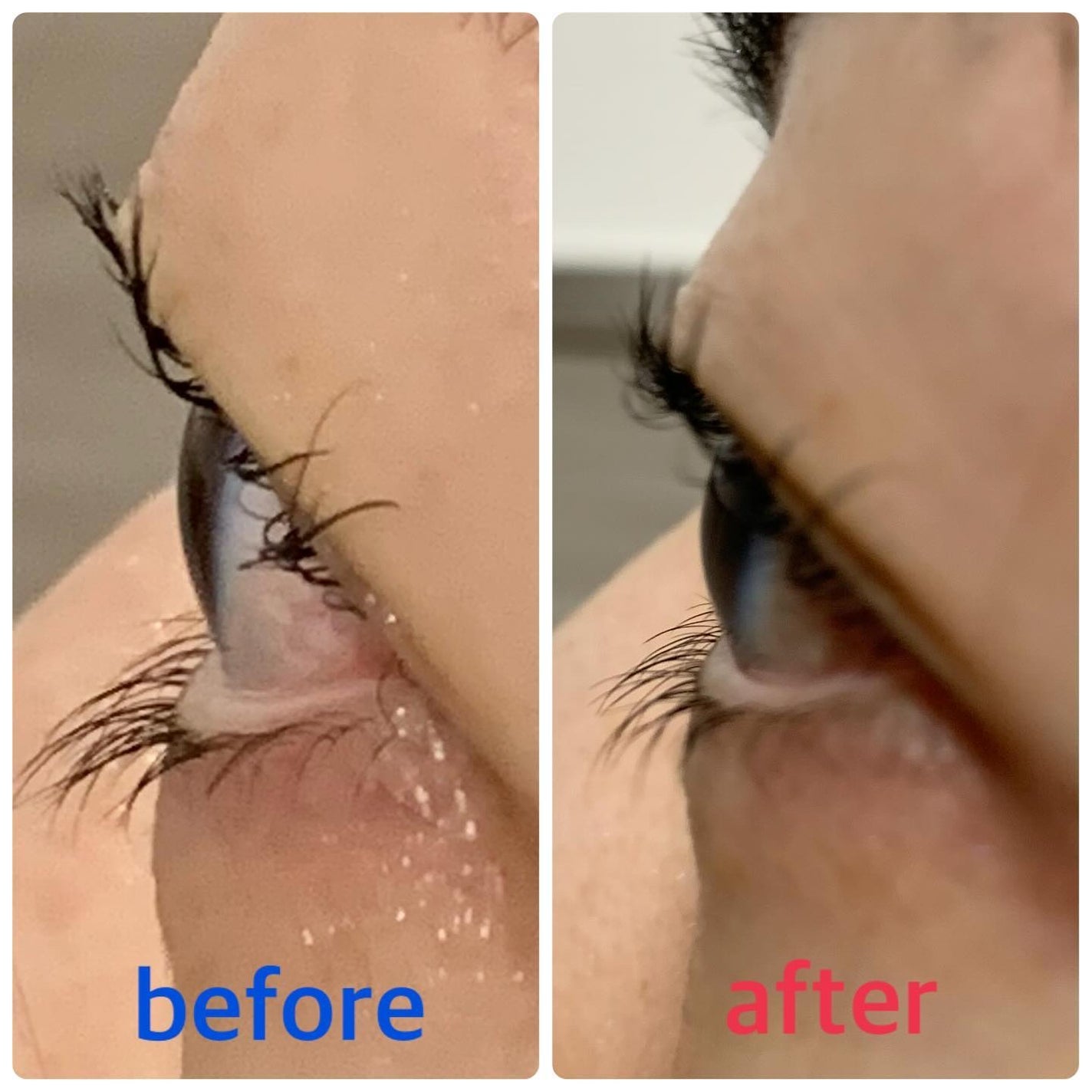 アイパワーセラム/グラングレイ/その他スキンケアを使ったクチコミ(4枚目)