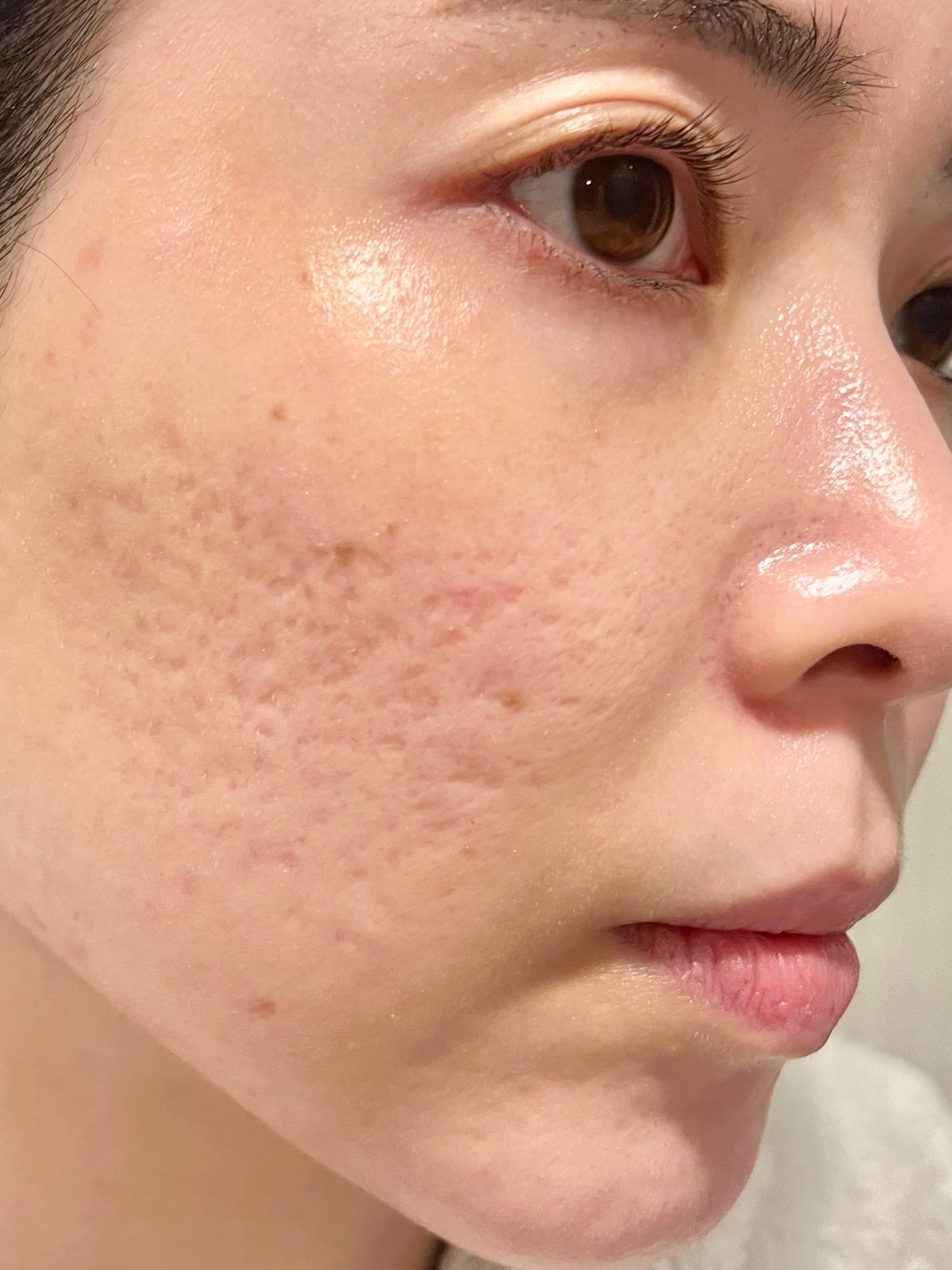 PDRNピンクアンプル PDRN 10,000ppm配合/MEDICUBE/美容液を使ったクチコミ(5枚目)