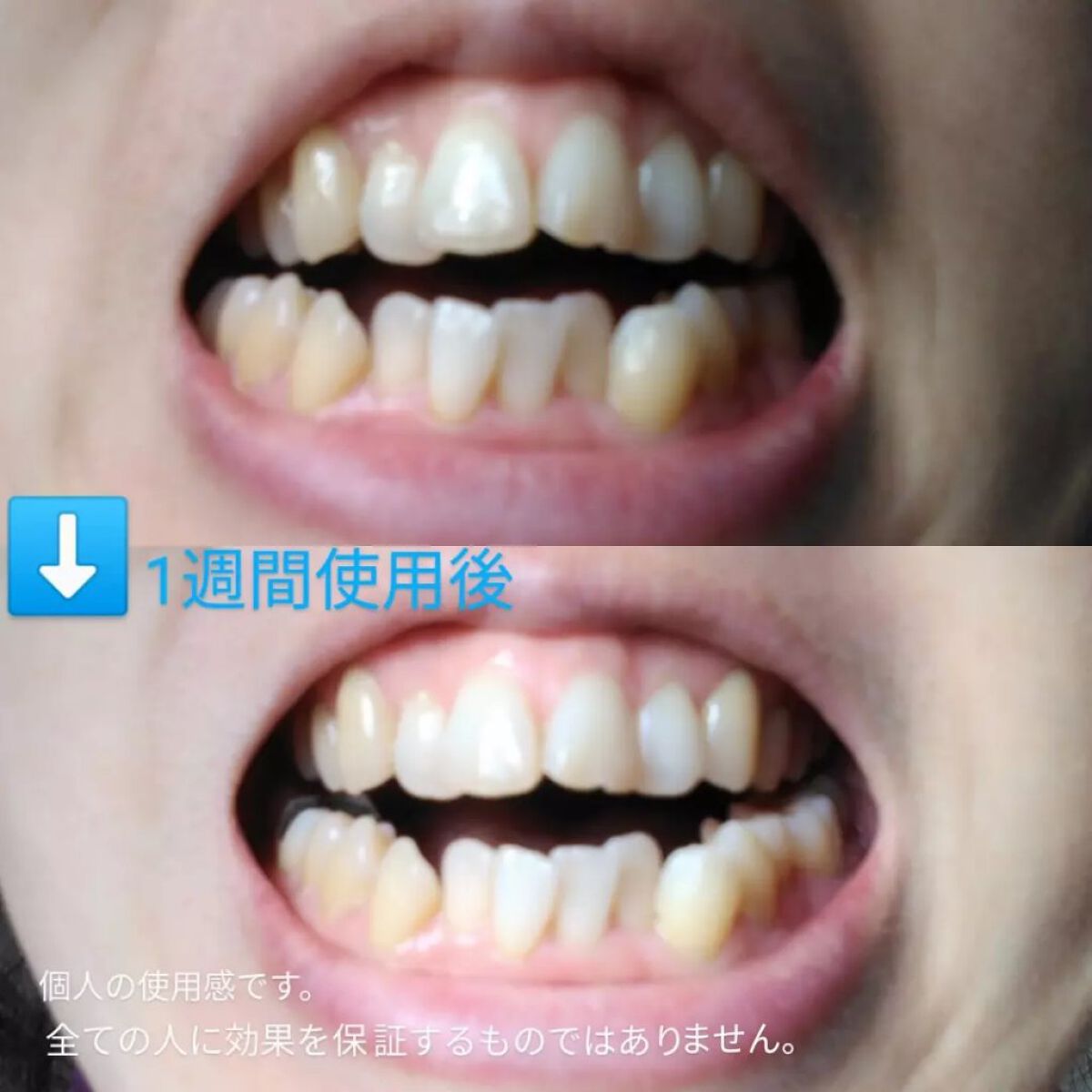 CURAPROX CS 5460/CURAPROX/歯ブラシを使ったクチコミ(3枚目)