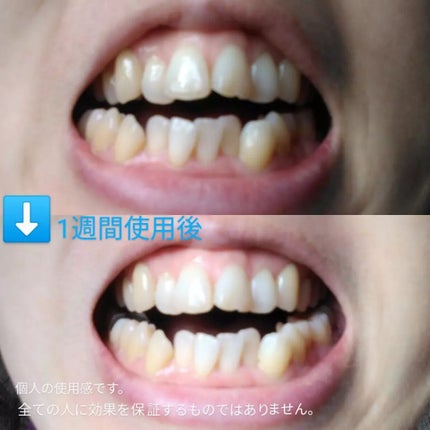 CURAPROX CS 5460/CURAPROX/歯ブラシを使ったクチコミ(3枚目)