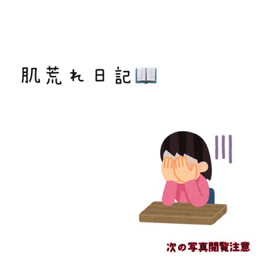 お久しぶりです🧽

前回の投稿から半年?ぐらい経ちました〜
なんか証明オレンジすぎてちょっと分からりずらいけど、だいぶ治ってきたんじゃなぁぁぁい??

【保湿まじで大事】これに尽きるわ👨‍🏭
