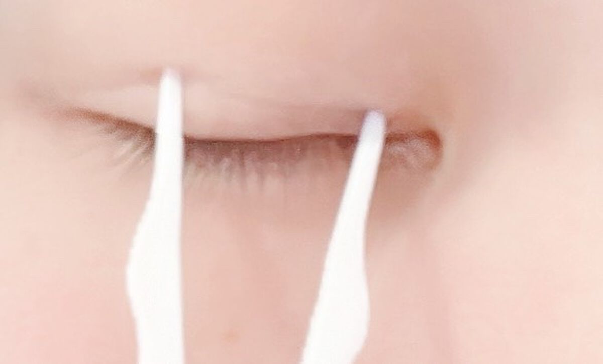 タフグルーX/フィクシー/二重まぶた用アイテムを使ったクチコミ(6枚目)