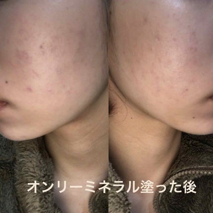 ファンデーション/ONLY MINERALS/ルースパウダーを使ったクチコミ(3枚目)
