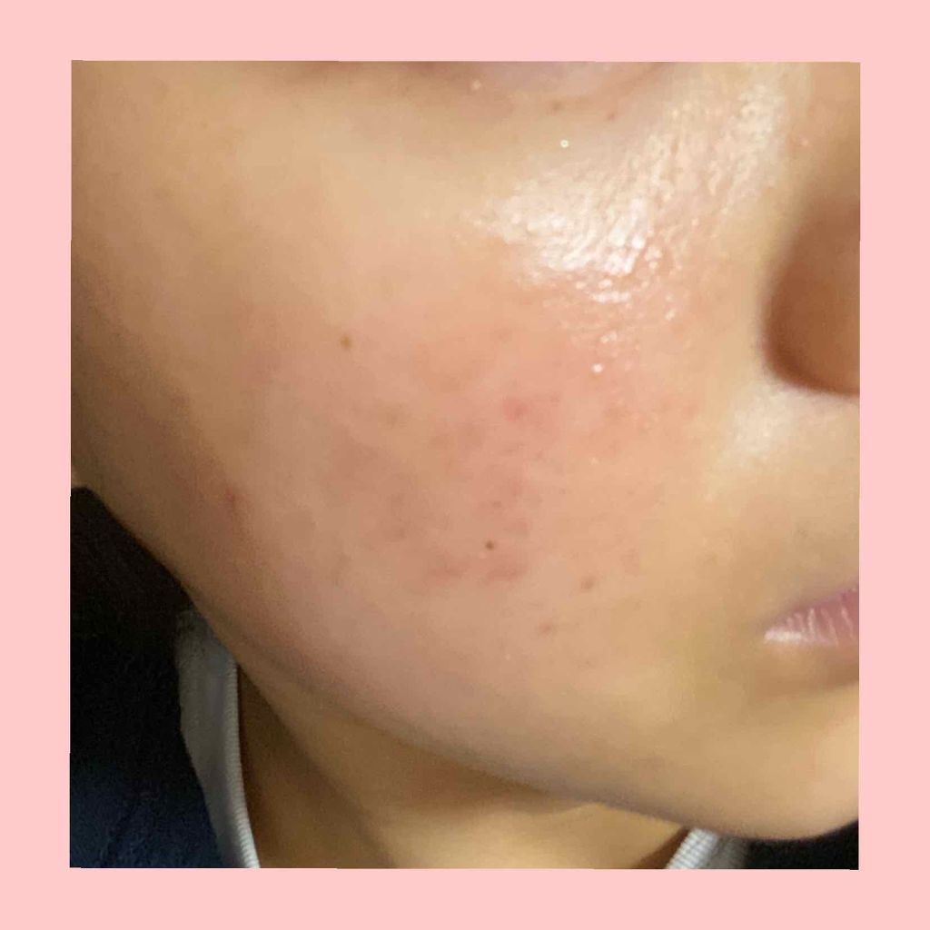 ニベアクリーム/ニベア/ボディクリームを使ったクチコミ（3枚目）