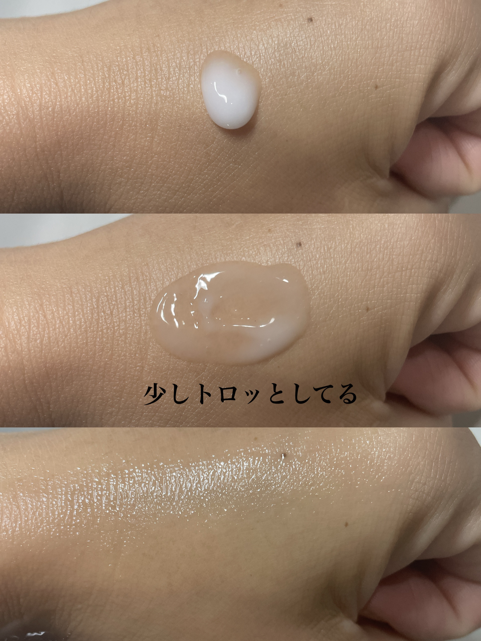 リードルショット300/VT/美容液を使ったクチコミ（2枚目）