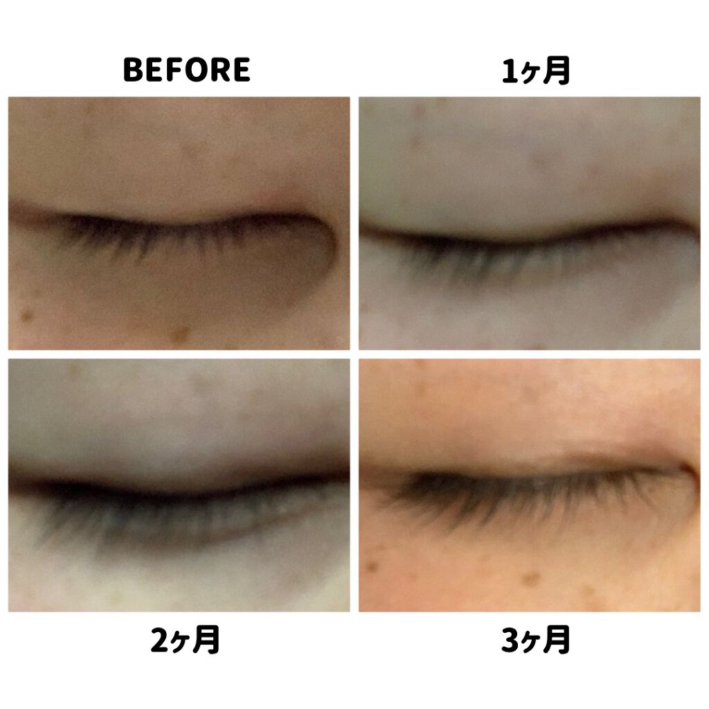 EMAKED(エマーキット)/水橋保寿堂製薬/まつげ美容液を使ったクチコミ(3枚目)