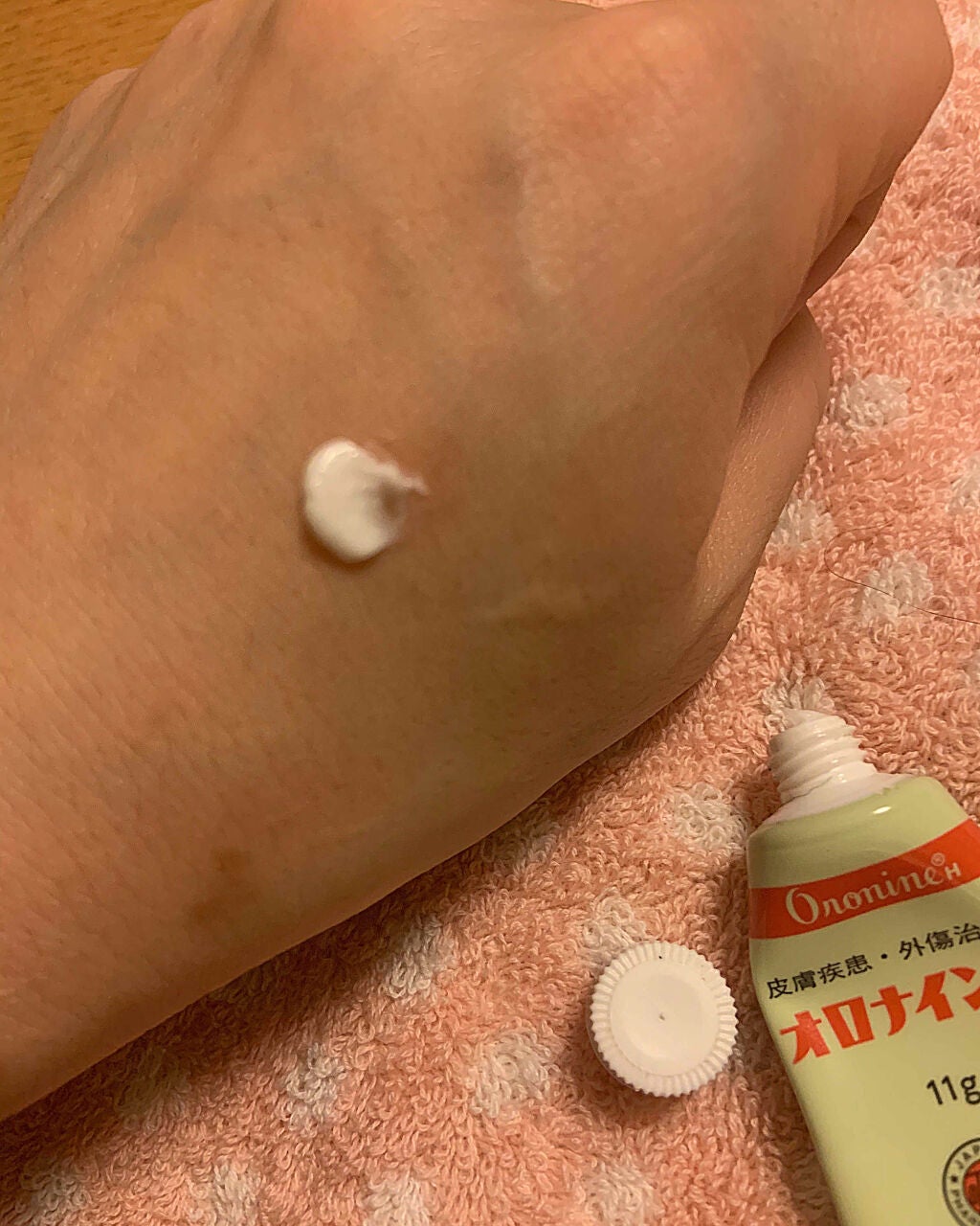オロナインH軟膏 (医薬品)/オロナイン/その他を使ったクチコミ(3枚目)