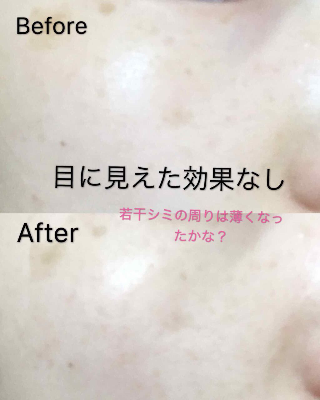 ハイドロクリーム SHQ-10/KISO/フェイスクリームを使ったクチコミ(2枚目)