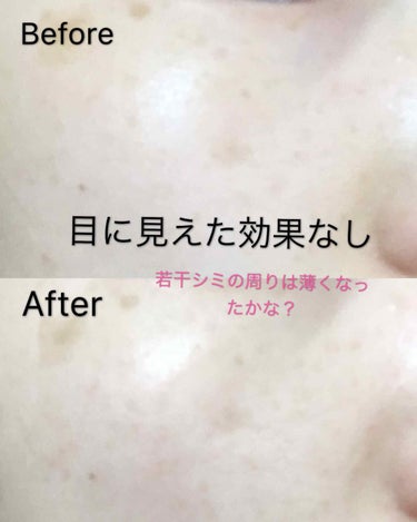 試してみた】ハイドロクリーム SHQ-10/KISO | LIPS