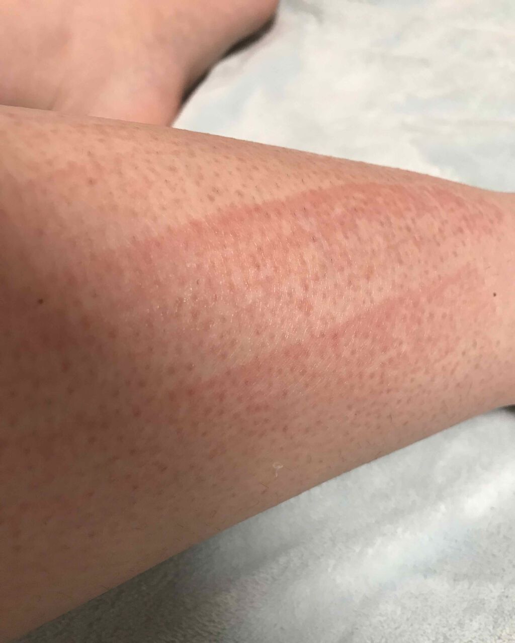 マイルド＆モイスチャーアロエジェル/ネイチャーリパブリック/ボディローションを使ったクチコミ（2枚目）