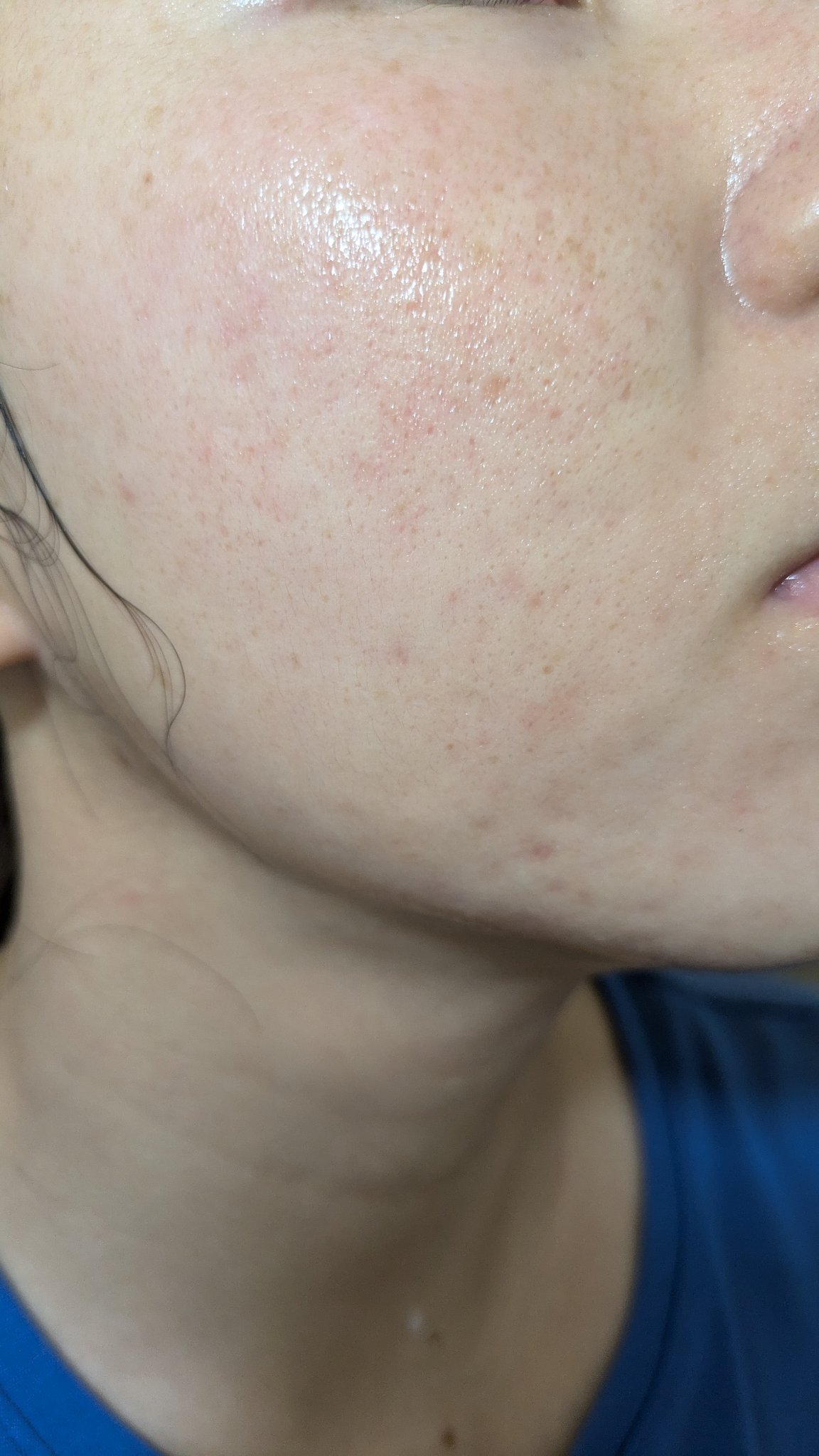 A2+NAG2ソリューション/The Ordinary/美容液を使ったクチコミ（1枚目）