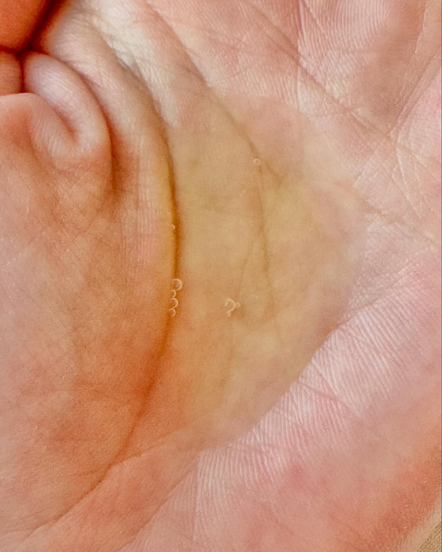 V エッセンス/unlabel/美容液を使ったクチコミ（3枚目）