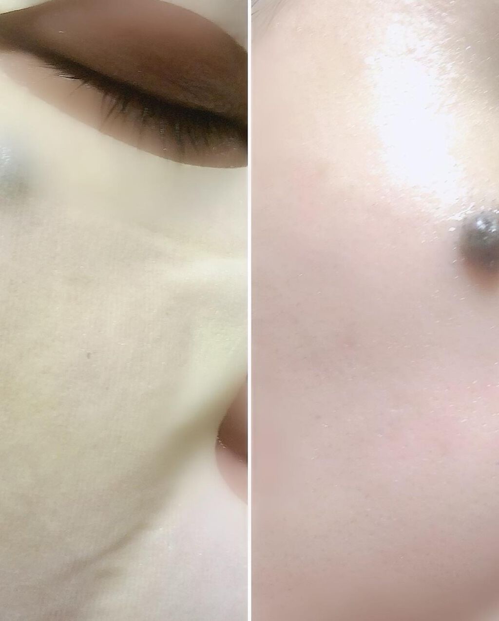 ハニーシールドマスクパック 1枚入/Re Gen/シートマスク・パックを使ったクチコミ（3枚目）