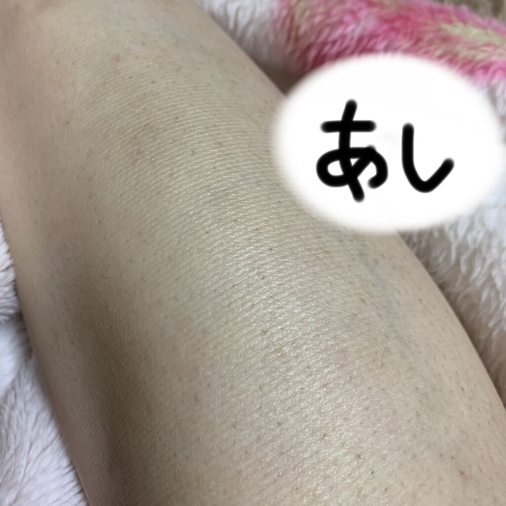 光脱毛器 VIO/Sarlisi/家庭用脱毛器を使ったクチコミ（3枚目）